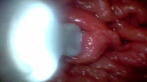 First time: An endoscope reveals the G-spot up close &ndash; without mounting!