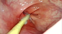 EXTREME ANAL POV. CAMERA INSIDE HER ASSHOLE AS I POUND HER WITH MY BIG COCK AND CUM DEEP INSIDE