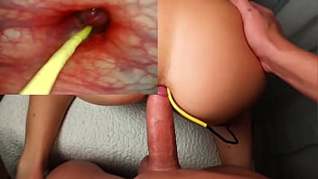 Amazing anal. Camera in Her Ass Deep Anal Fuck and Internal Creampie 13 min