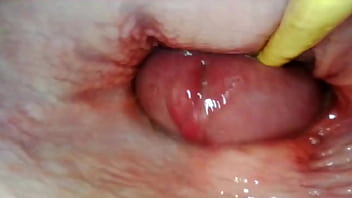 AMAZING INTERNAL POV. CAMERA INSIDE HER PUSSY WHILE I FILL HER WITH CUM 10 min