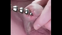 Fast sounding with 10mm Steel. Harnr&ouml;hre geflickt und das peehole mit dicken Kugel Sound bearbeitet.